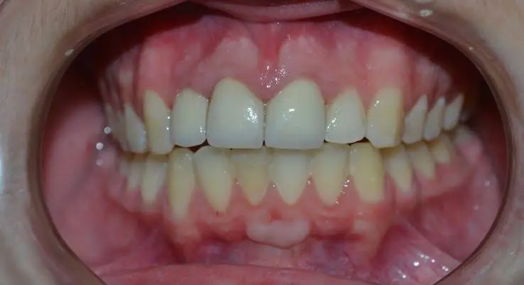 Emergency Dental Services