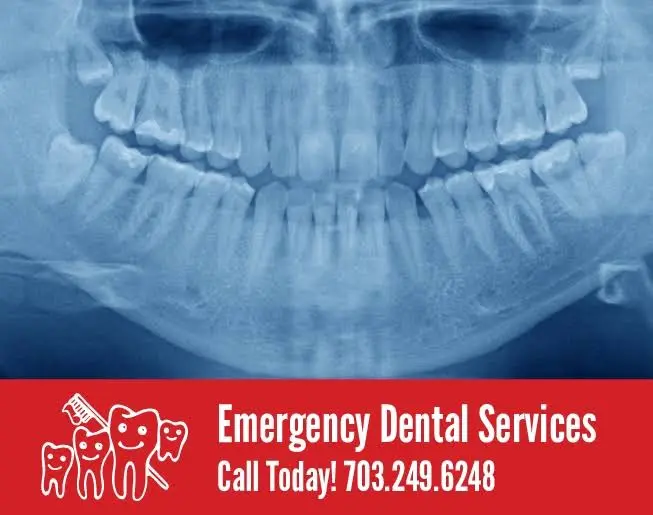 Emergency Dental Services