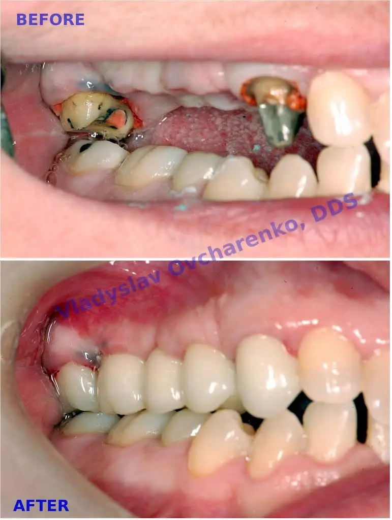 Fairfax City Dentist PLC. Vladyslav Ovcharenko, DDS