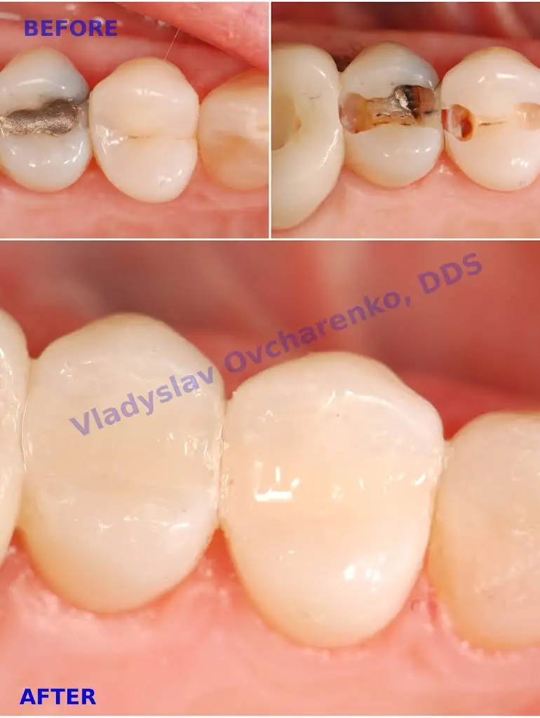 Fairfax City Dentist PLC. Vladyslav Ovcharenko, DDS