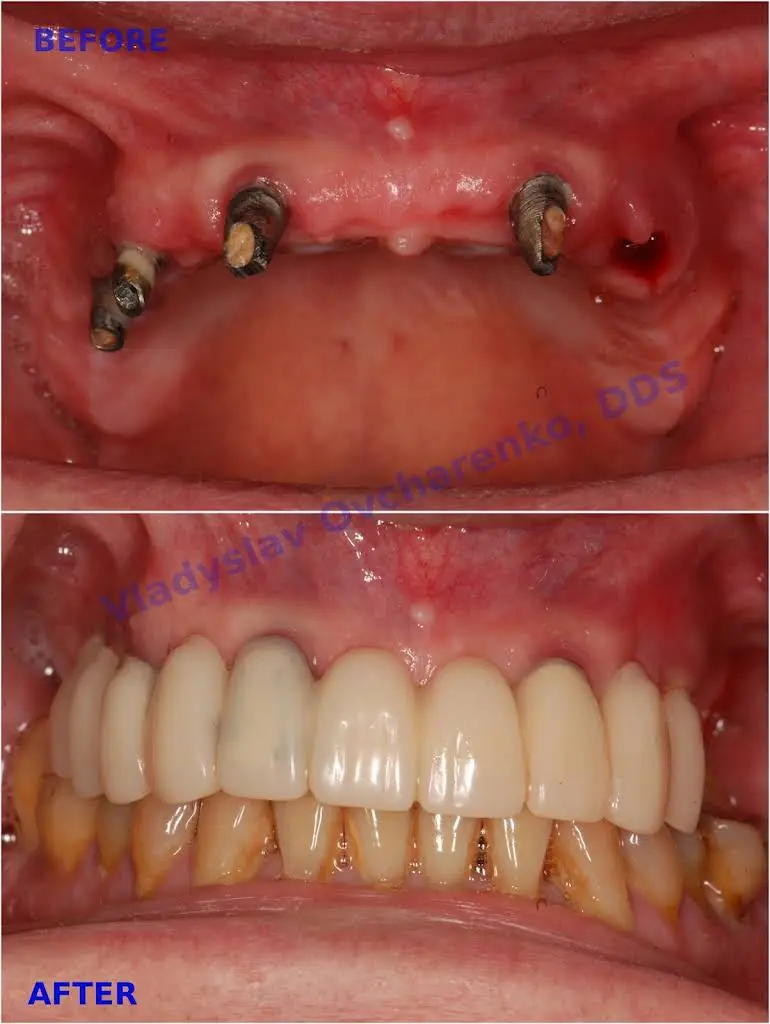 Fairfax City Dentist PLC. Vladyslav Ovcharenko, DDS