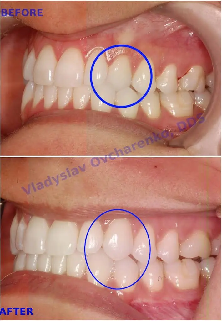 Fairfax City Dentist PLC. Vladyslav Ovcharenko, DDS