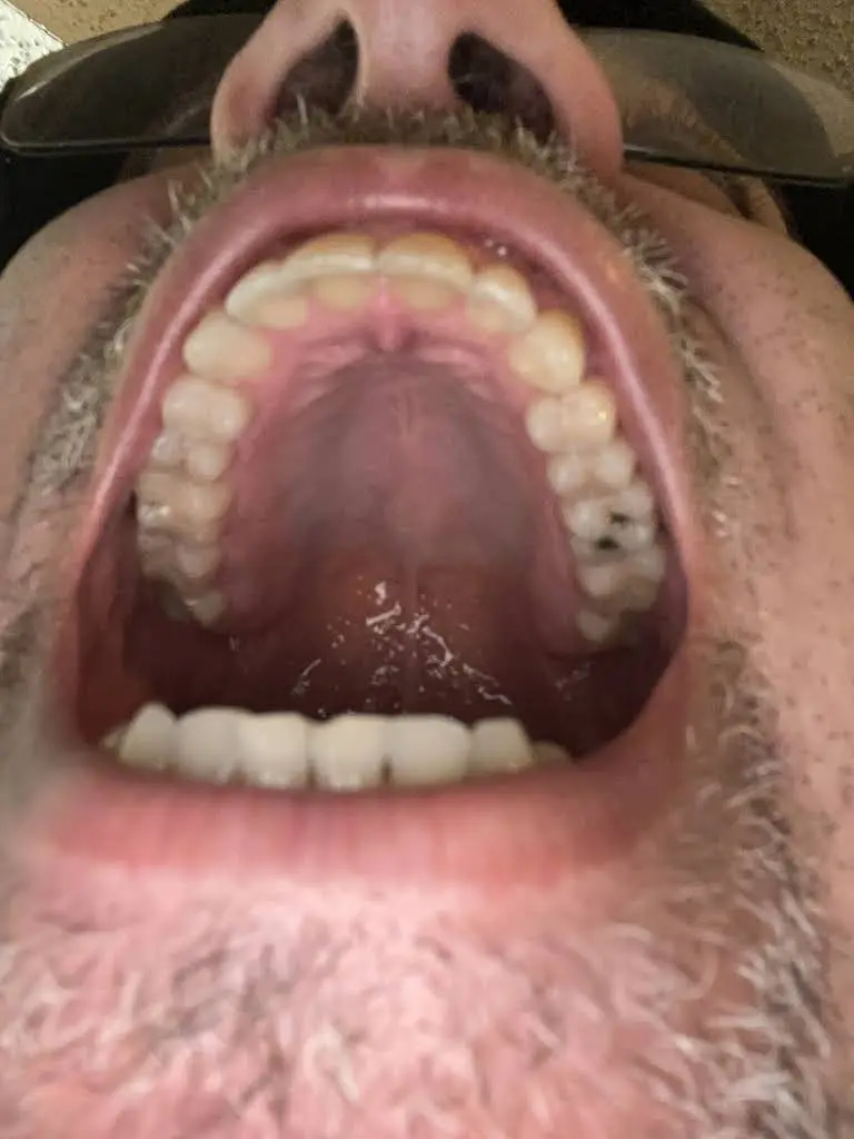 Gentle Dental Care