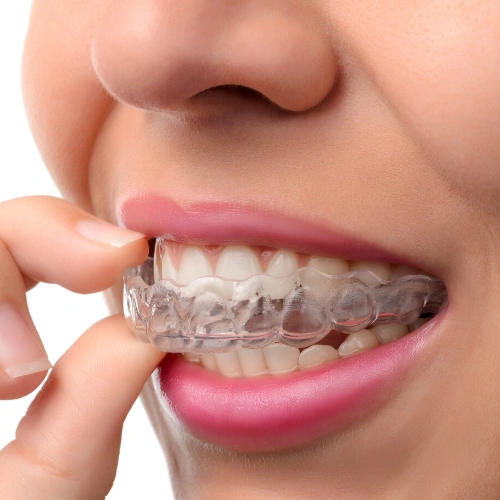 Sherry Kazerooni, DDS, LVIF