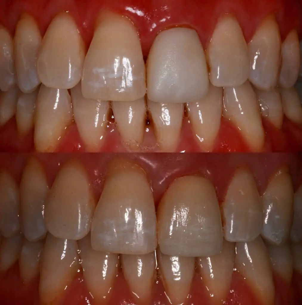 Sherry Kazerooni, DDS, LVIF