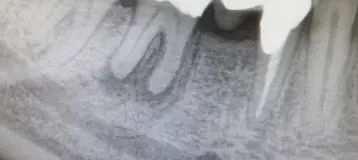 Impression Dental PC