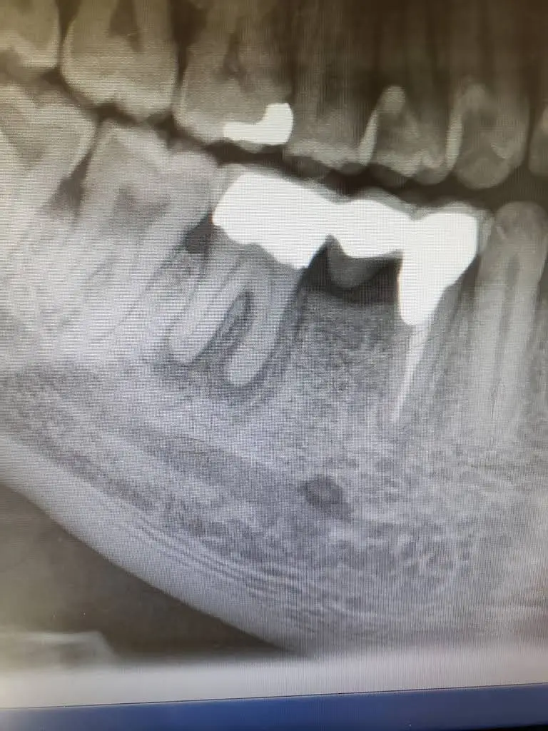 Impression Dental PC