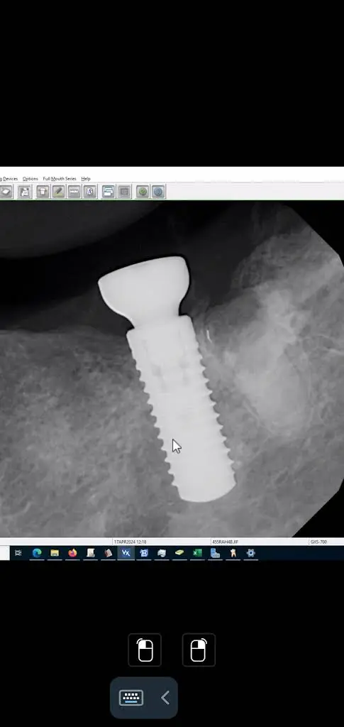 Impression Dental PC