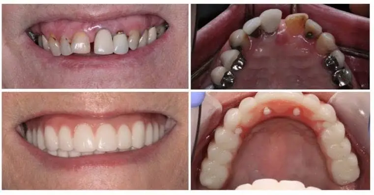 Salud Dental of Waukegan