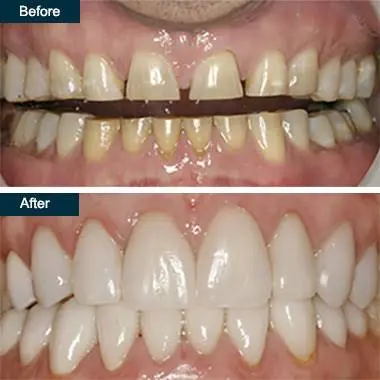 Salud Dental of Waukegan