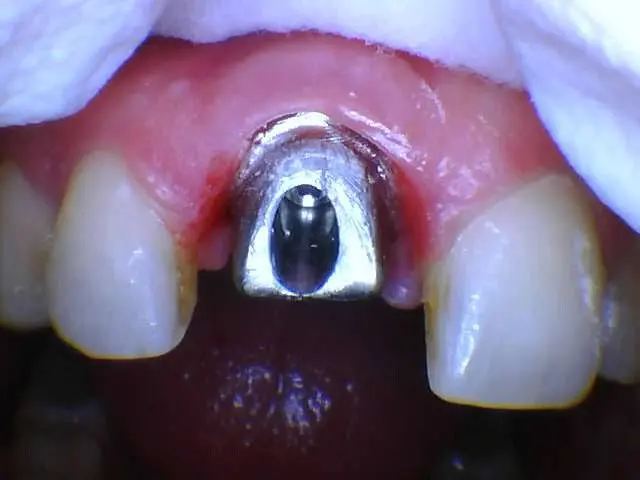 Ashley Family Dental