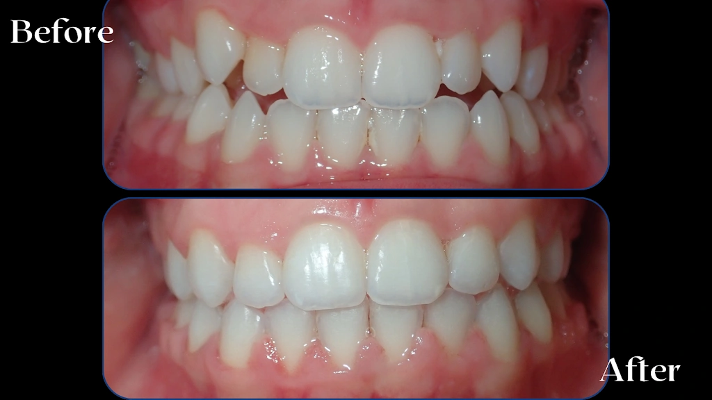 All Smiles Orthodontics