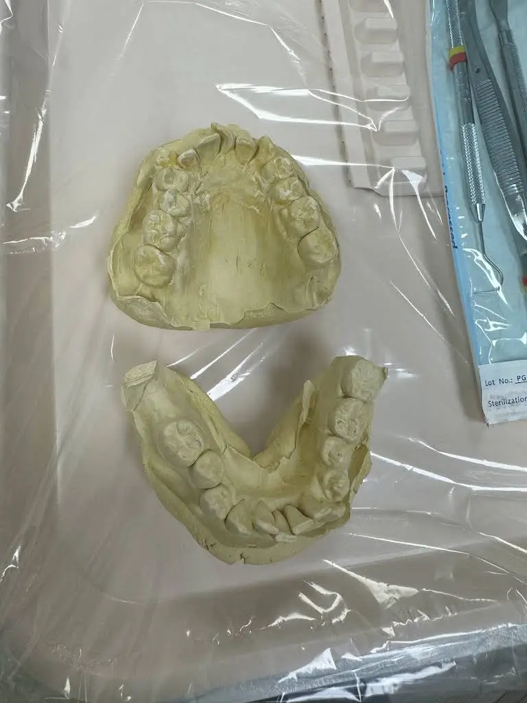 Nothing But The Tooth