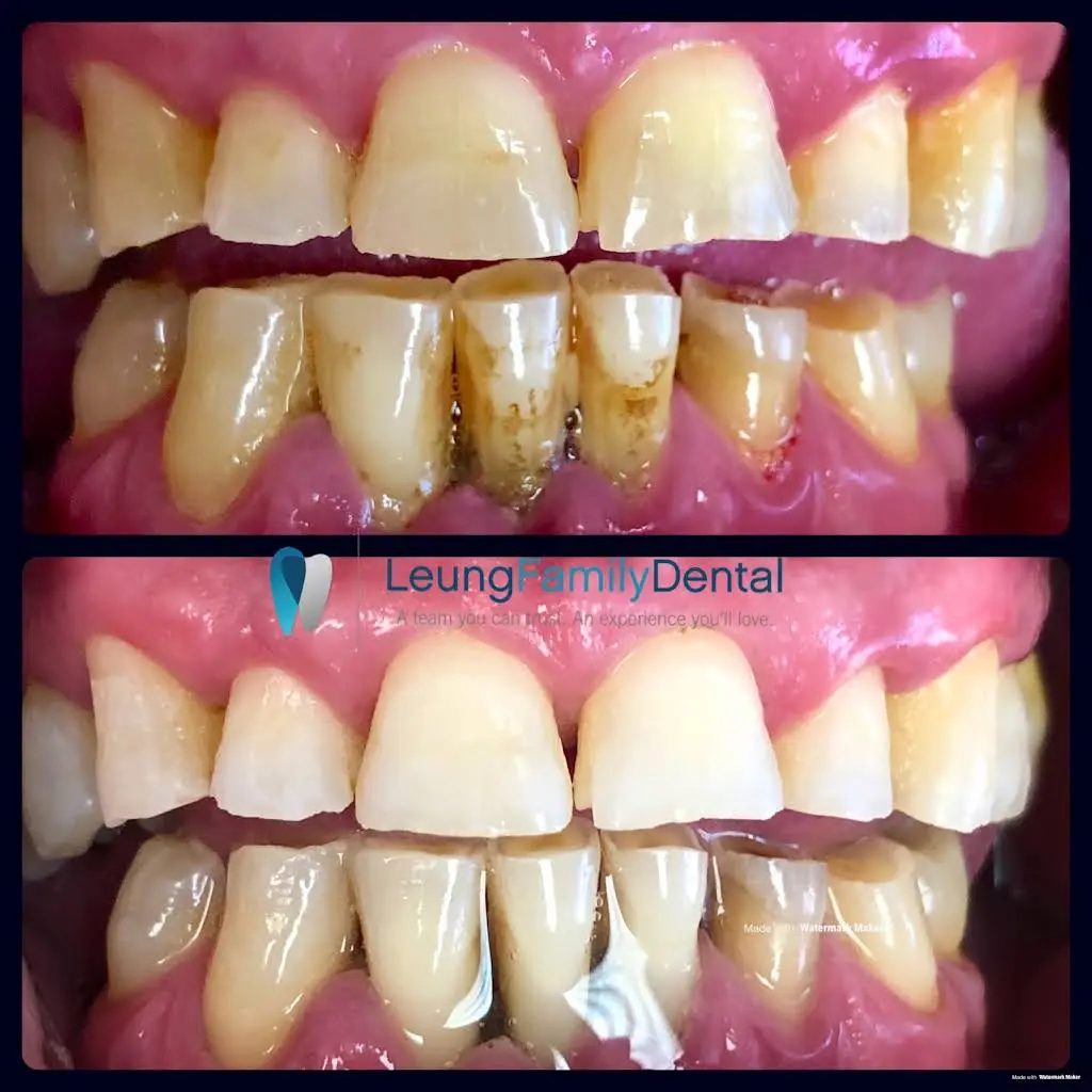 Leung Family Dental