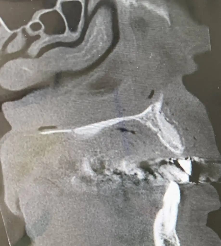 Sundance Implant and Periodontal Center