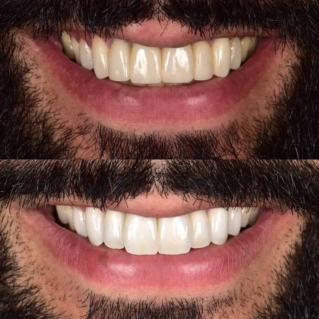 Smile Designs of Olney - Mitchell A. Lomke, DDS & Joshua M. Lomke, DDS
