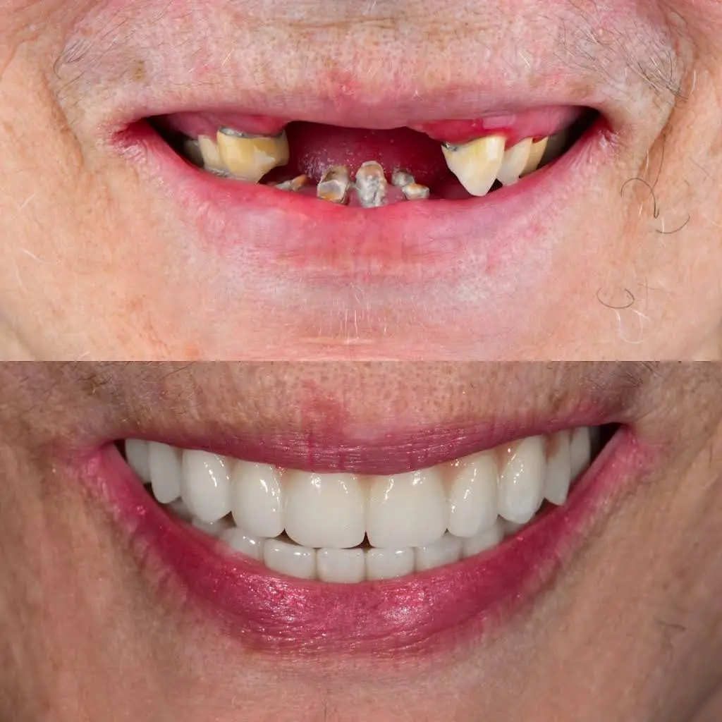 Smile Designs of Olney - Mitchell A. Lomke, DDS & Joshua M. Lomke, DDS