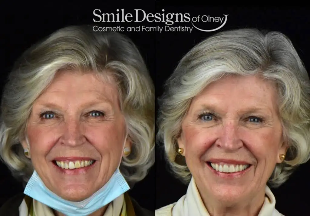 Smile Designs of Olney - Mitchell A. Lomke, DDS & Joshua M. Lomke, DDS
