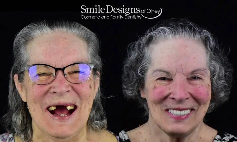 Smile Designs of Olney - Mitchell A. Lomke, DDS & Joshua M. Lomke, DDS