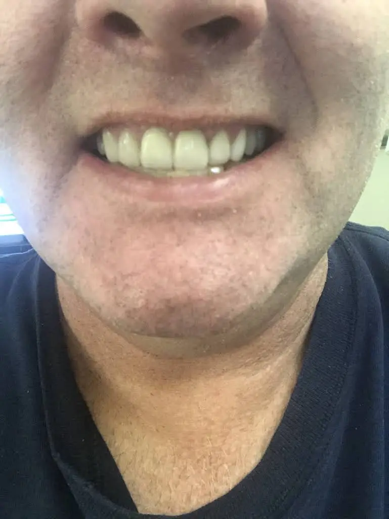 Olney Smiles Advanced Dentistry
