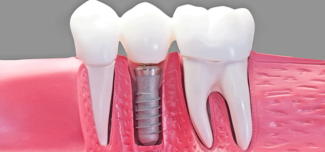 Laurel Pines Dental Group