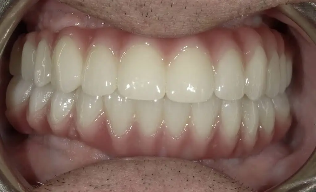Laurel Bowie Implant & Cosmetic Dentistry