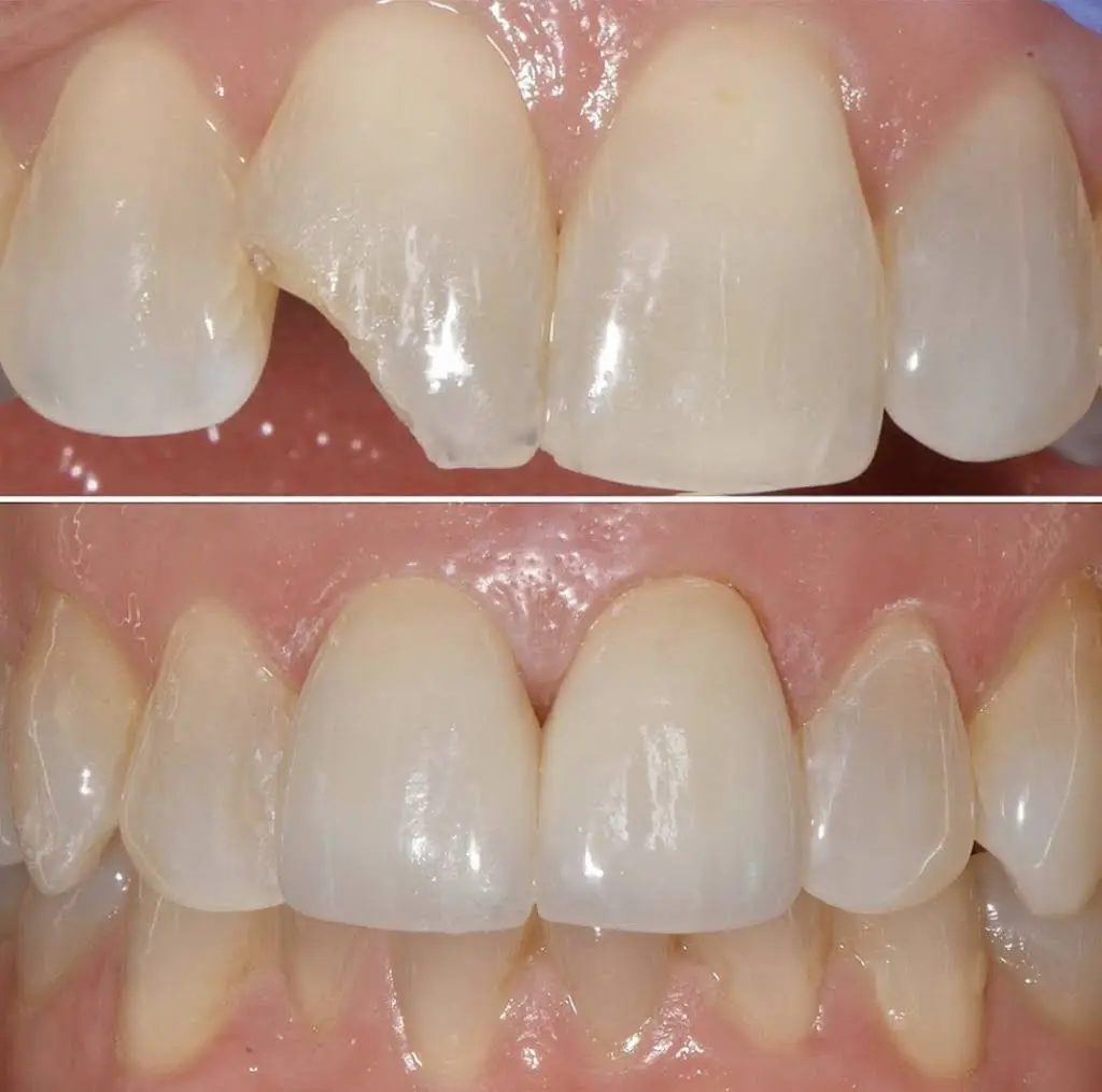 Laurel Bowie Implant & Cosmetic Dentistry