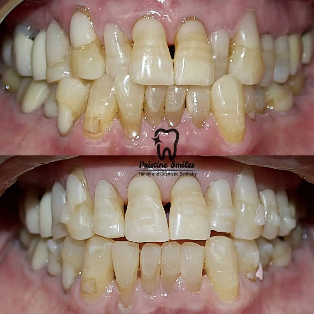 Pristine Smiles