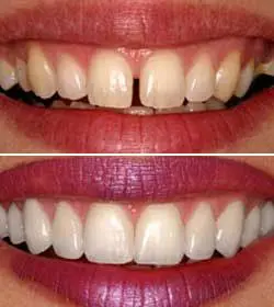 Natural Dentist Associates