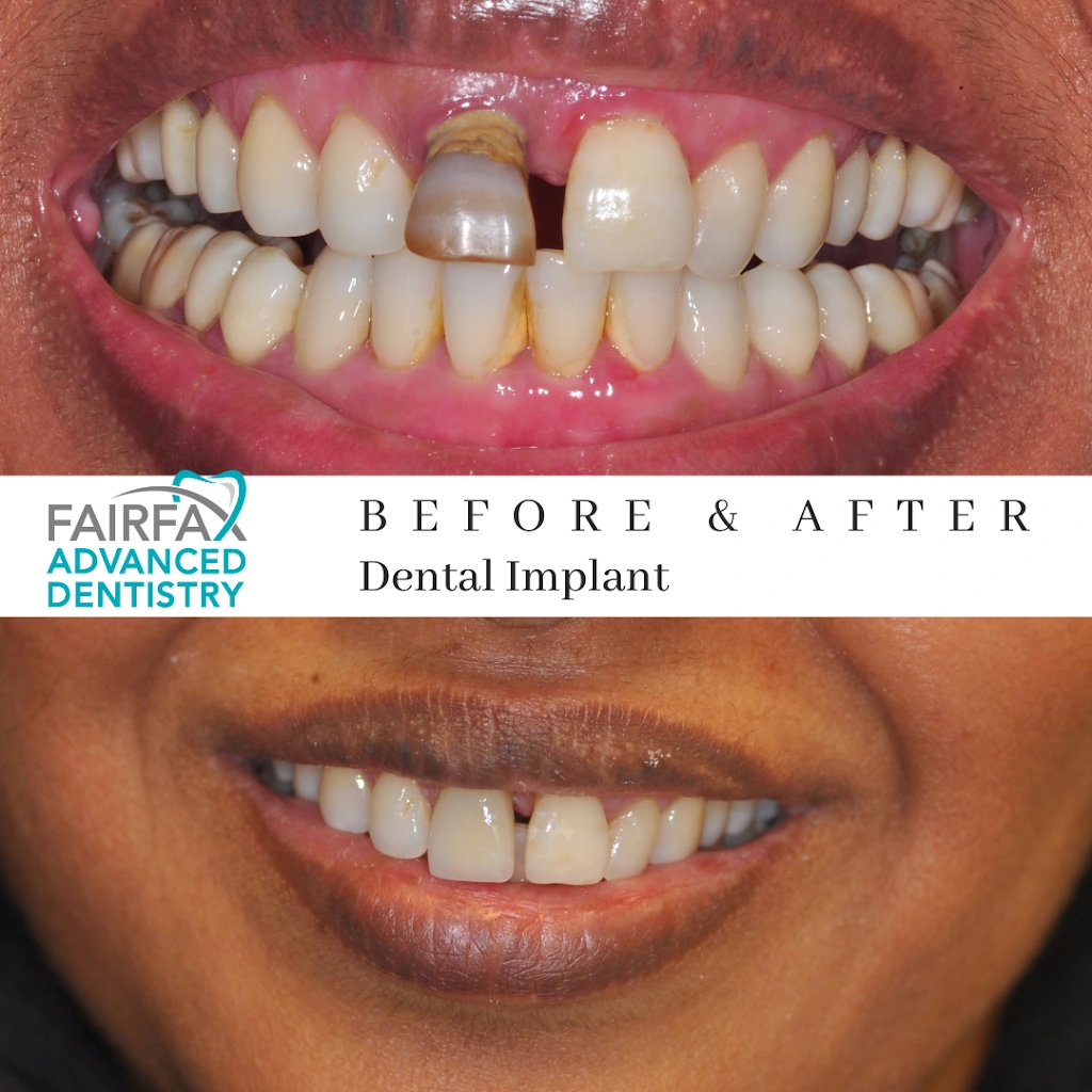 Fairfax Advanced Dentistry