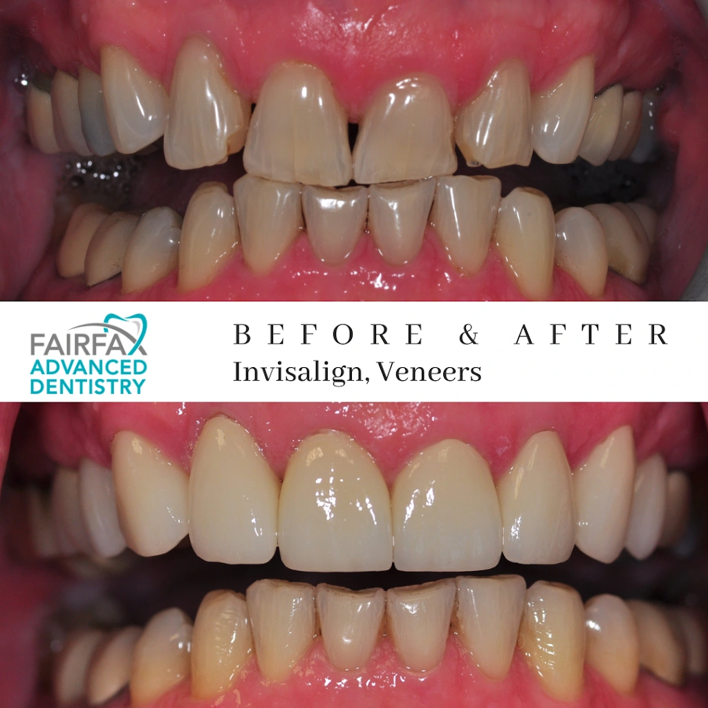 Fairfax Advanced Dentistry