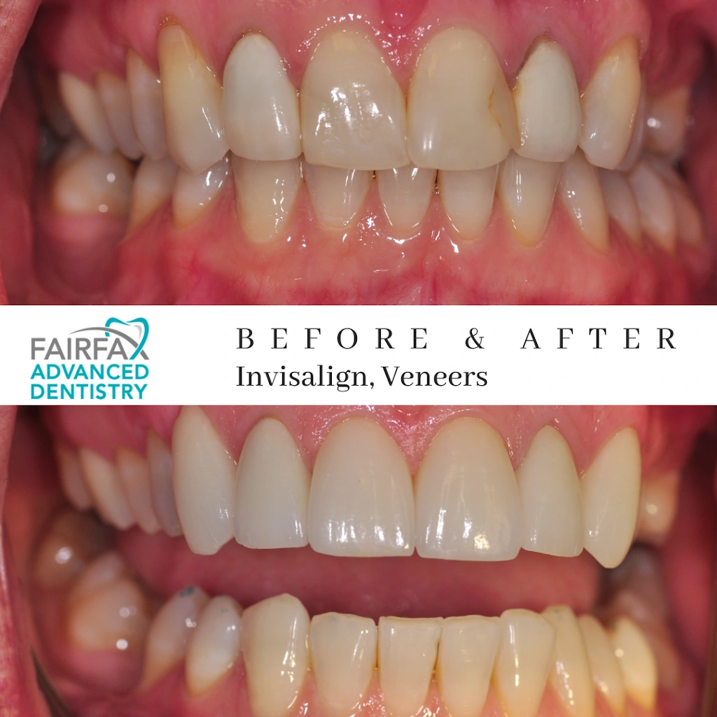 Fairfax Advanced Dentistry