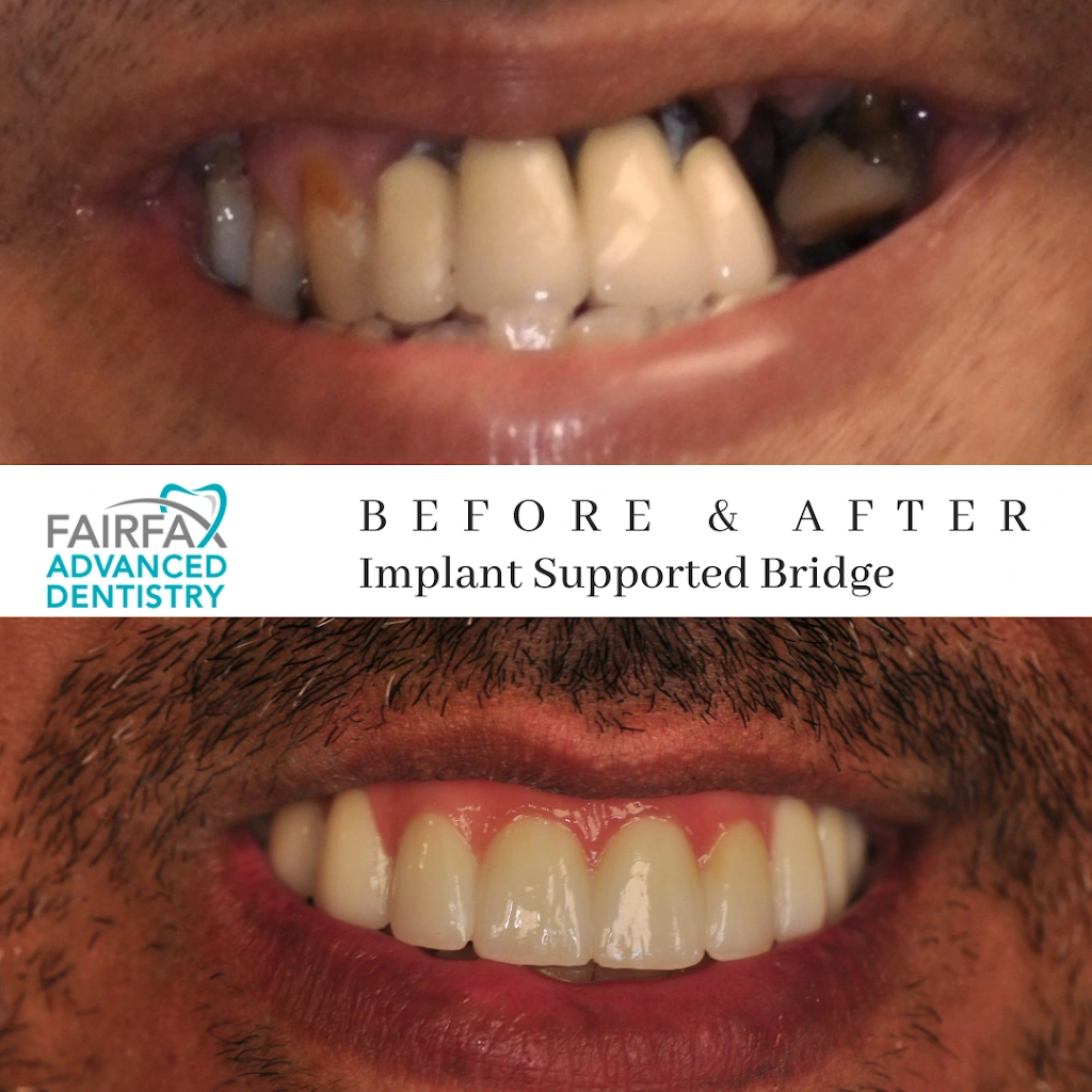 Fairfax Advanced Dentistry