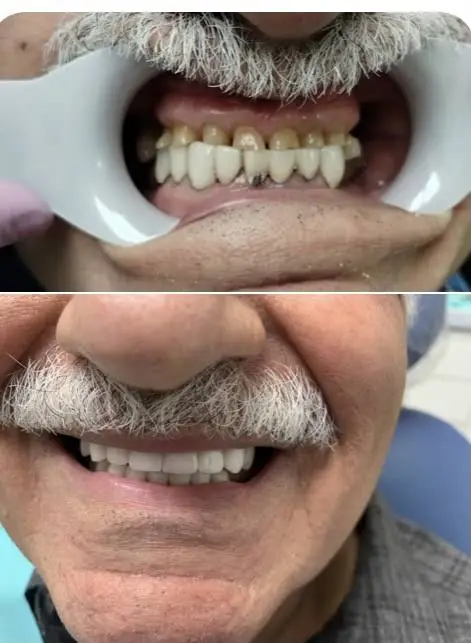 Alpine Dental