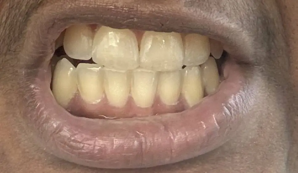 Neibauer Dental Care