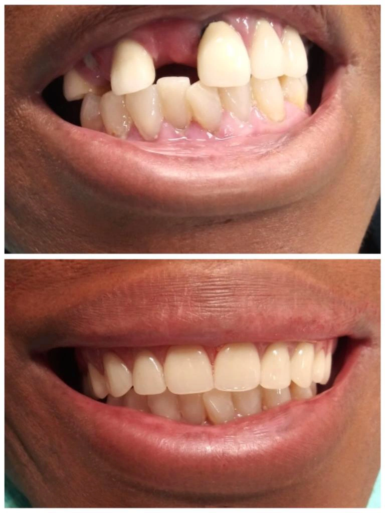 Fort Washington Dentist