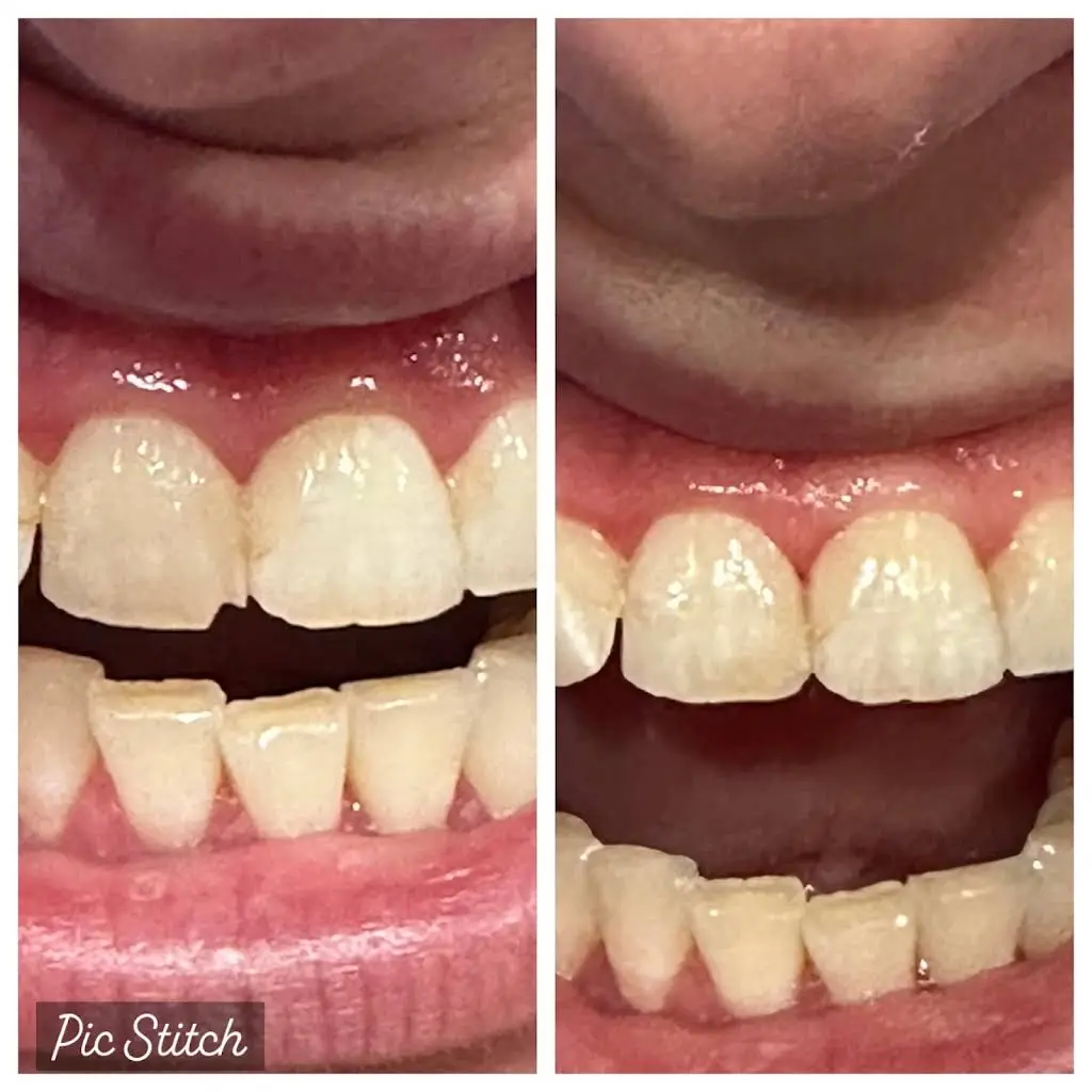 East Troy Family Dental