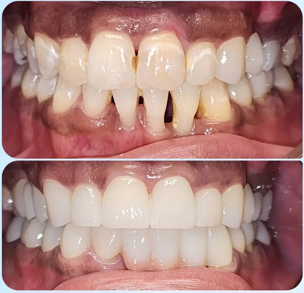 A To Z Dental