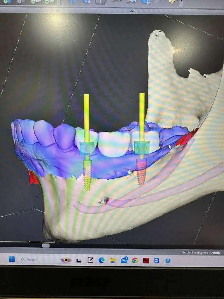 The Periodontal Group - Dr. Basel Hajjar