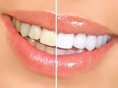 Smile Designs of Olney