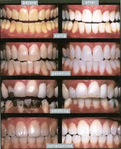 Olney Dental
