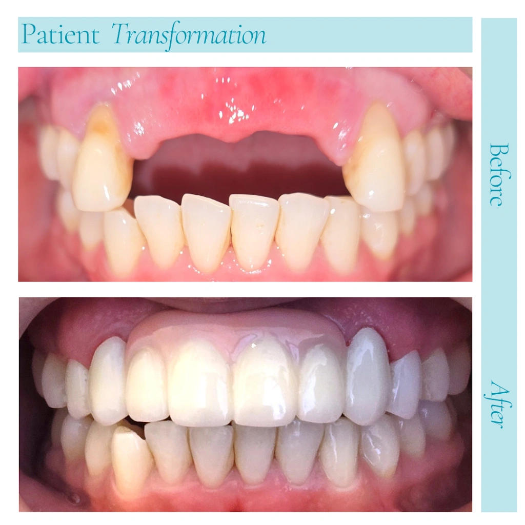 Joobbani Dental Designs
