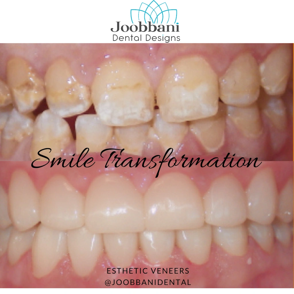 Joobbani Dental Designs