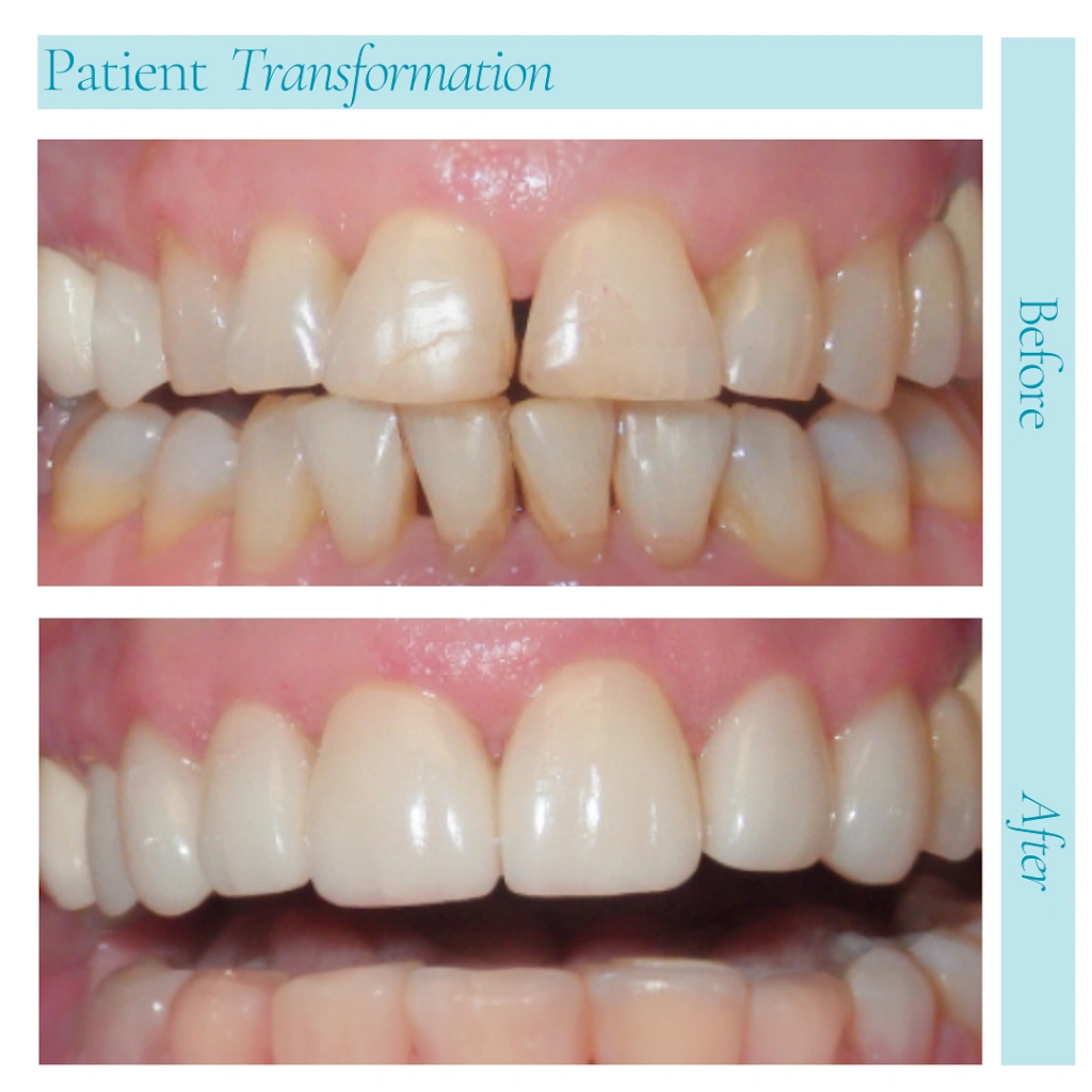Joobbani Dental Designs