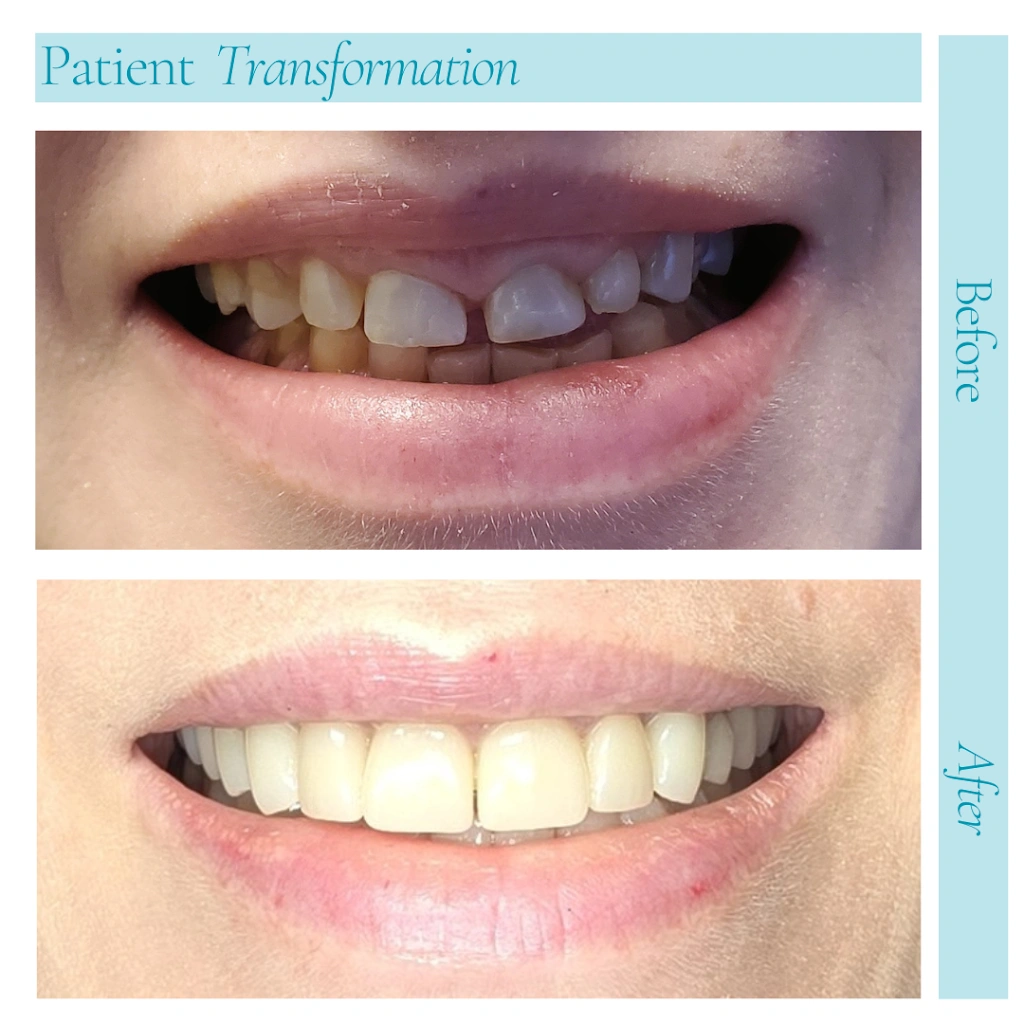 Joobbani Dental Designs