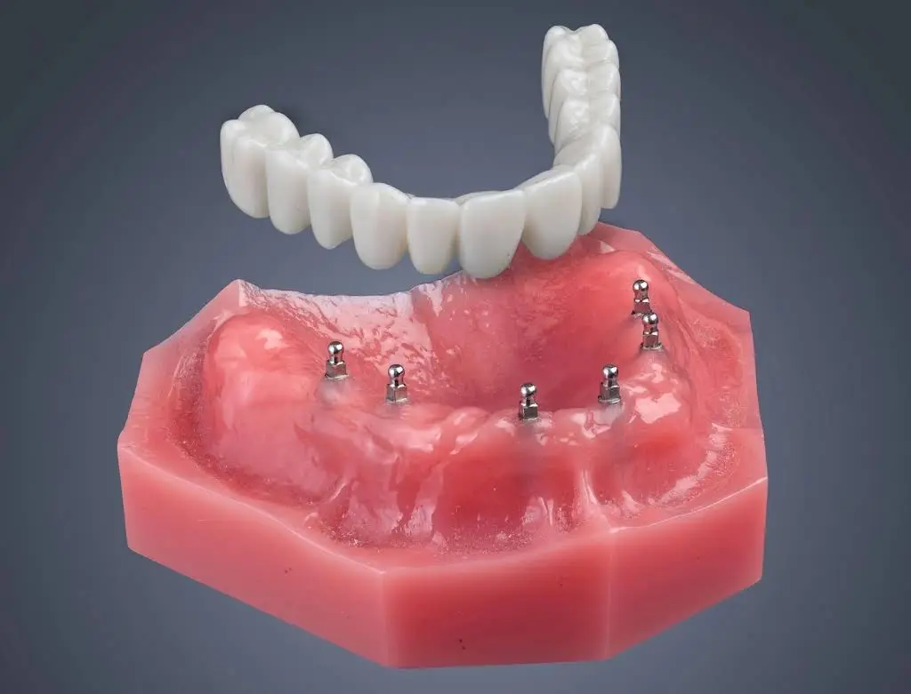 Armani Dentures