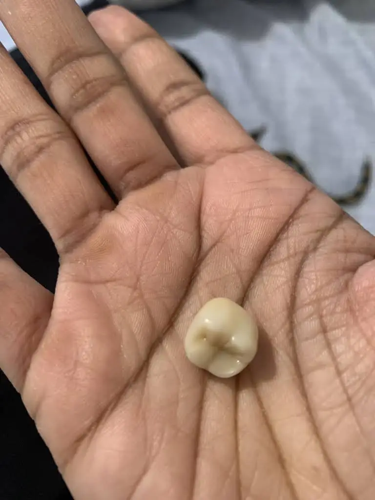 Armani Dentures