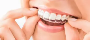 Complete Family Dental Care