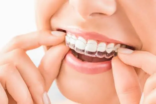 Complete Family Dental Care