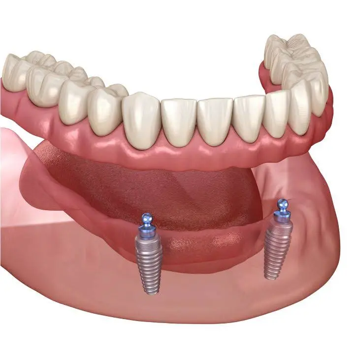 Rockville Family Dental - Chetan H Parikh, DMD PA